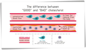 cholesterol-610x359