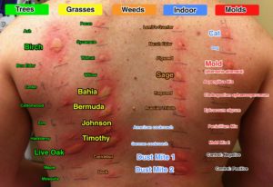 allergy_testing