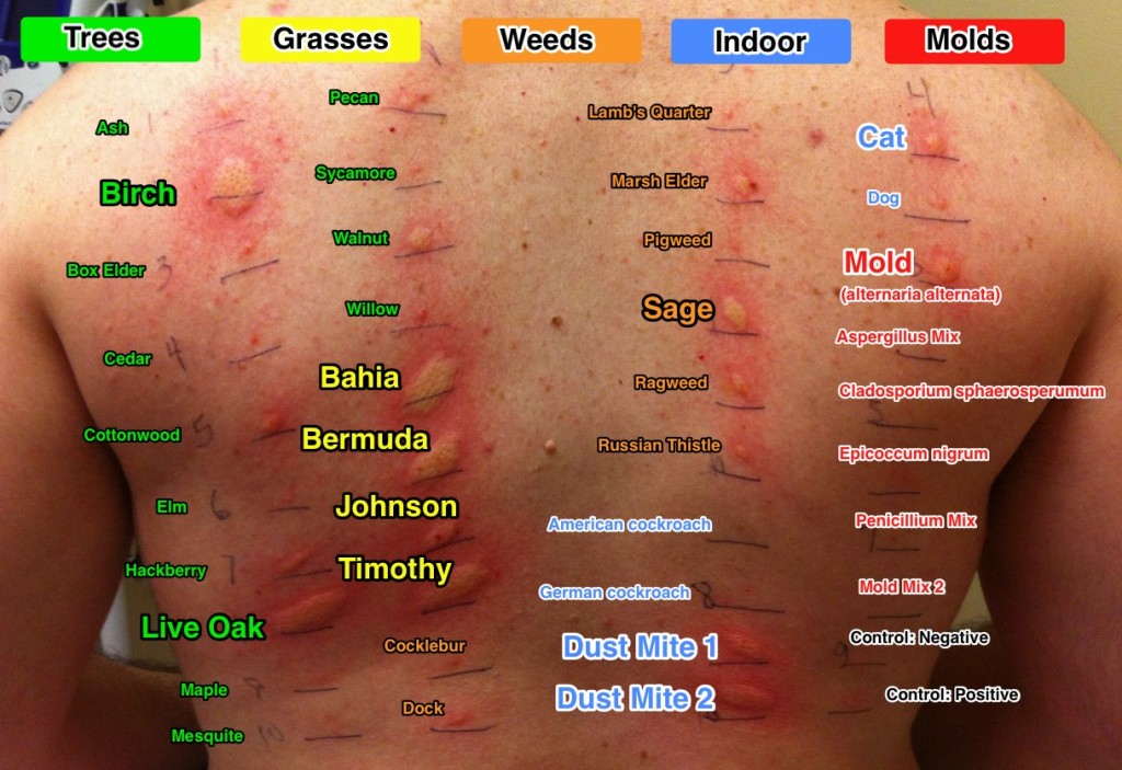 Beta-glucan vs. Allergies - Sofislife Corporation